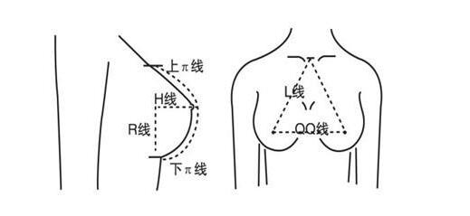 隆胸假體選擇對比攻略