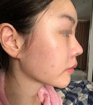 新一周醫(yī)美資訊熱點(diǎn)大集合【2020.5.25】