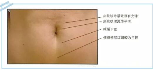 網(wǎng)紅抗衰項目熱瑪吉