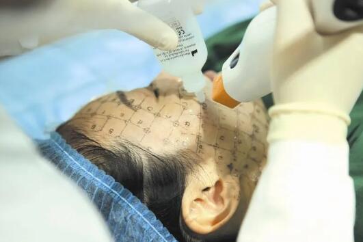 網(wǎng)紅抗衰項目熱瑪吉