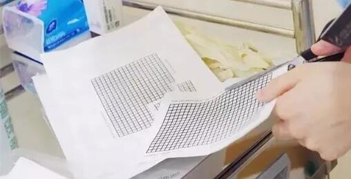 網(wǎng)紅抗衰項目熱瑪吉