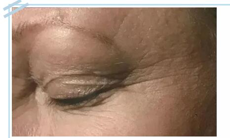 網(wǎng)紅抗衰項目熱瑪吉