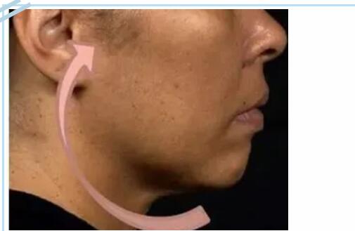 網(wǎng)紅抗衰項目熱瑪吉