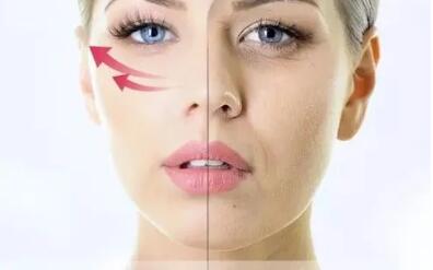 網(wǎng)紅抗衰項目熱瑪吉