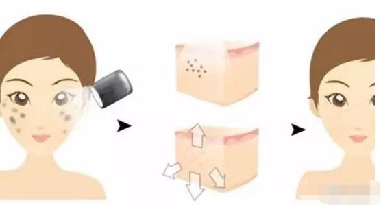 夏季是“醫(yī)美黃金期”這些適合做的醫(yī)美項(xiàng)目