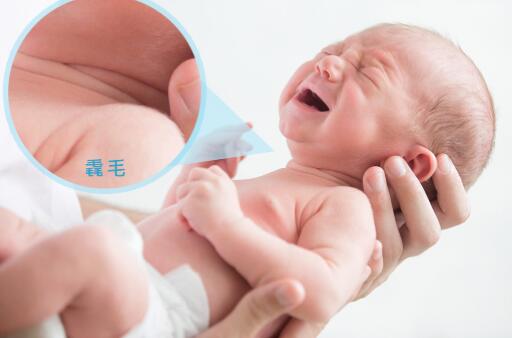 做為女生，為什么我的體毛這么粗濃？冰點(diǎn)脫毛無顧慮