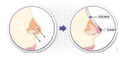 鼻子的美可是至關(guān)重要