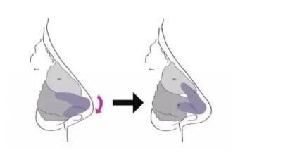 鼻子的美可是至關(guān)重要