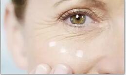 魚尾紋的四個(gè)等級(jí)