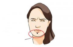 東莞人民醫(yī)院美容科手術(shù)切痣多少錢 會(huì)留疤嗎