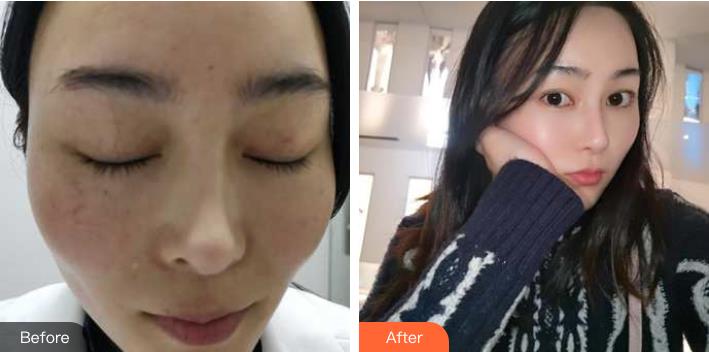 肖倩醫(yī)生--重慶美侖美奐整形美容醫(yī)院