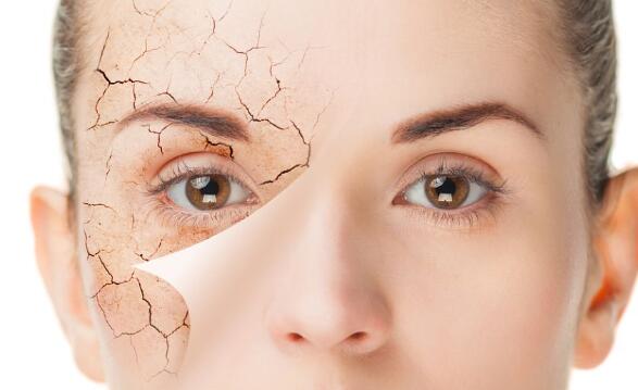 自體脂肪填充淚溝有需要特別注意的嗎?注意事項大全公開