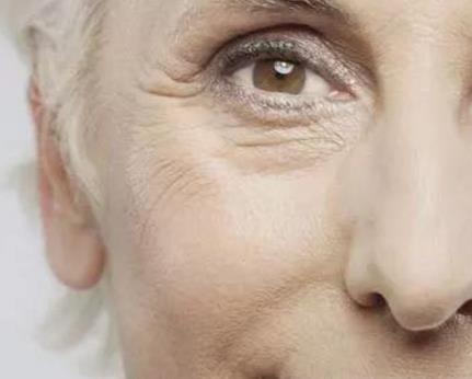 眼皮松弛怎么辦？如何避免眼皮松弛的情況？