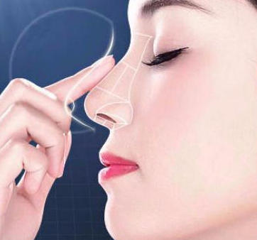 隆鼻不想做肋軟骨還能選什么方案？看上海九院劉凱怎么說