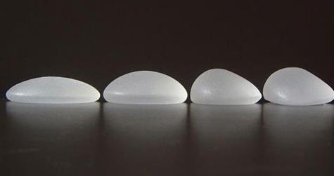 麥格隆胸怎么樣？有哪些優(yōu)點？