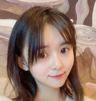 成都奕后孟祥宏醫(yī)生做隆鼻修復(fù)咋樣?僅三個月就宛若天生