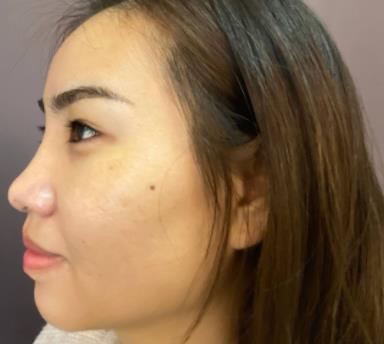 北京楊明勇技術(shù)好嗎？真人親身經(jīng)歷記錄&果展示