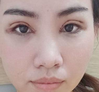 北京楊明勇技術(shù)好嗎？真人親身經(jīng)歷記錄&果展示