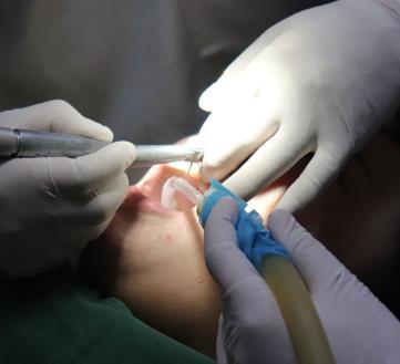 四川省人民醫(yī)院口腔科李崢醫(yī)生咋樣?牙齒矯正費(fèi)用多少?