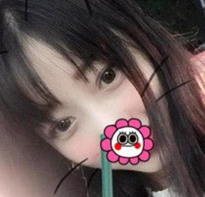 【冷向鋒案例】青醫(yī)附院雙眼皮術(shù)后恢復(fù)記錄公開，速覽