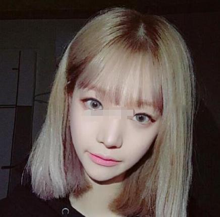 上海九院韋敏磨骨怎么樣?術(shù)后日記經(jīng)驗分享