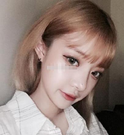 上海九院韋敏磨骨怎么樣?術(shù)后日記經(jīng)驗分享