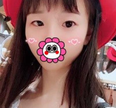 沈陽(yáng)杏林張瑩瑩雙眼皮案例？看醫(yī)生簡(jiǎn)介和技術(shù)如何