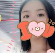 成都華西醫(yī)院雙眼皮做的怎么樣？看真人案例展示醫(yī)生技術(shù)！