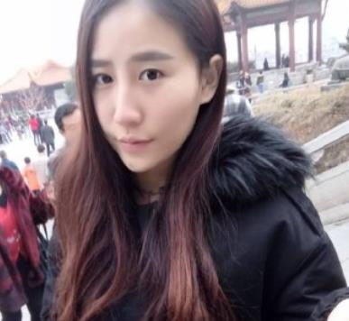 北京藝美王東醫(yī)生脂肪填充案例公開，術(shù)后太陽(yáng)穴飽滿自然