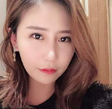 北京藝美王東醫(yī)生脂肪填充案例公開，術(shù)后太陽(yáng)穴飽滿自然