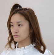 成都米蘭柏羽雙眼皮果實(shí)錘，術(shù)后升高了顏值！