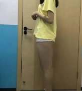山東省立醫(yī)院整形科高峰大腿吸脂如何？案例對比證實醫(yī)生技術(shù)！