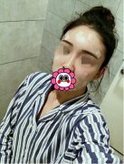 溫州藝星醫(yī)學美容醫(yī)院自體脂肪填充面部果反饋，飽滿自然少女臉