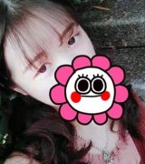 重慶附一院整形科張恒術(shù)雙眼皮案例可參考：果不讓你們失望！