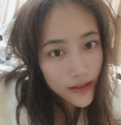 上海九院整形科隆鼻案例術(shù)后恢復(fù)過(guò)程反饋圖分享，自然還沒(méi)有留疤