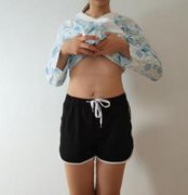 成都玉之光大腿吸脂案例分享，瘦腿就是這么簡(jiǎn)單！