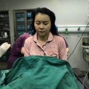 煙臺鵬愛整形面部埋線提升前后對比圖+醫(yī)院醫(yī)生介紹與推薦