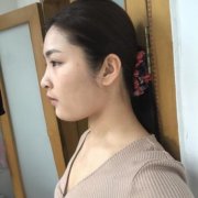 淮安市婦幼保健院整形科隆胸口碑好嗎？真人案例果照片瞧瞧吧！