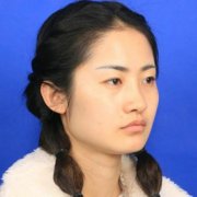 北京262醫(yī)院整形美容外科價格表收費明細！并附下頜角磨骨案例果圖