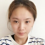 湖南省人民醫(yī)院皮膚科做水光補(bǔ)水好嗎？案例術(shù)后果展示