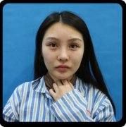 深圳壹秀醫(yī)療熱瑪吉怎么樣? 貴不貴？案例果一覽