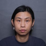 浙江省中醫(yī)院車菲雙眼皮提肌怎么樣？口碑及案例果圖查詢