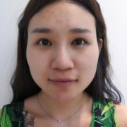 北京圣嘉榮是三甲醫(yī)院?jiǎn)幔磕ス前咐皟r(jià)格表在線預(yù)看