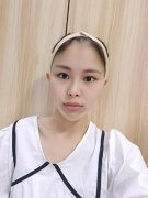 北大口腔醫(yī)院李自力正頜怎么樣？醫(yī)生案例果圖~恢復(fù)心得一覽