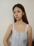 北京圣嘉新磨骨怎么樣？下頜角整形案例和優(yōu)惠價格查詢