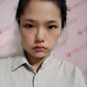 華西醫(yī)院整形美容科技術(shù)怎么樣？對(duì)比面部拉皮提升案例恢復(fù)果反饋