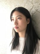 安康市人民醫(yī)院整形割雙眼皮案例~術(shù)后恢復(fù)果對比圖分享