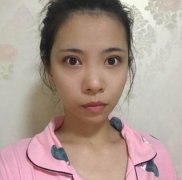 合肥市第一人民醫(yī)院整形科隆鼻貴嗎？真實案例和價格表一起瞧瞧~