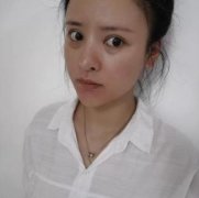 成都西區(qū)醫(yī)院整形科去眼袋果如何？真人案例恢復(fù)記錄查詢