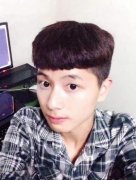 姜留剛割雙眼皮+開眼角案例在線一覽！來看術(shù)后果怎么樣？